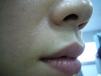 ����տsë��